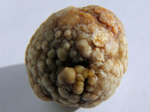 Yes, this is really a gall stone